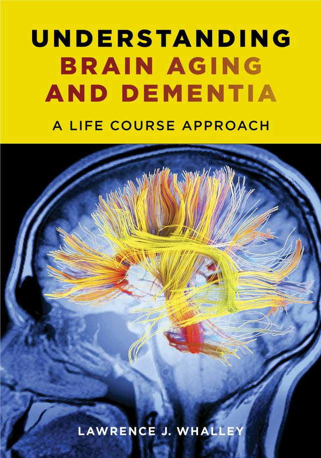 Understanding Brain Aging and Dementia by Lawrence J. Whalley