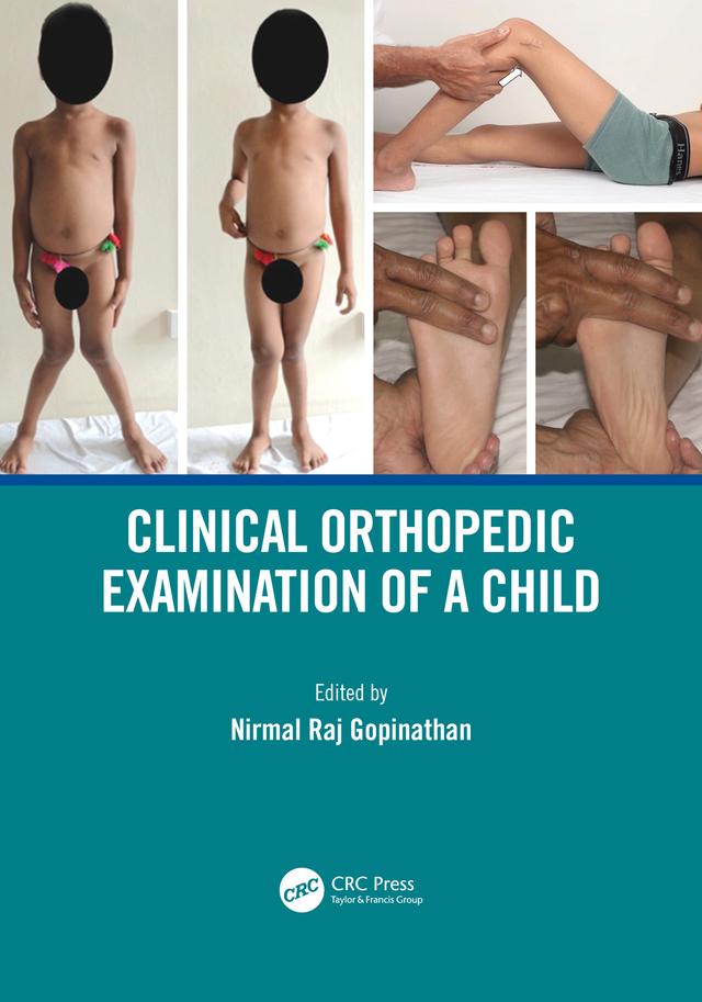 Clinical Orthopedic Examination of a Child by Nirmal Raj Gopinathan