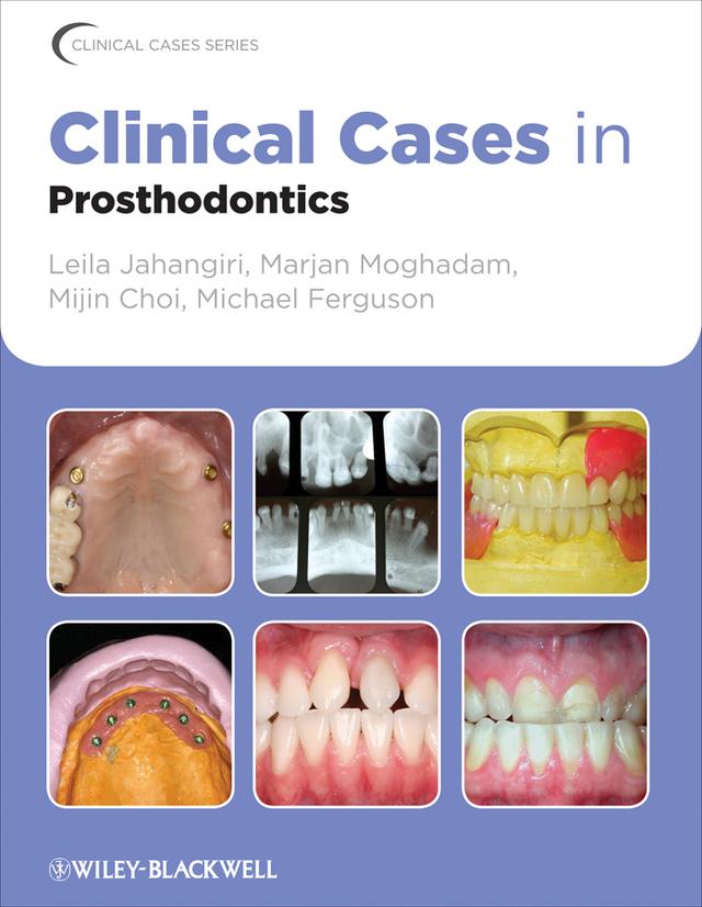 Clinical Cases in Prosthodontics by Leila Jahangiri, Marjan Moghadam, Michael Ferguson, Mijin Choi