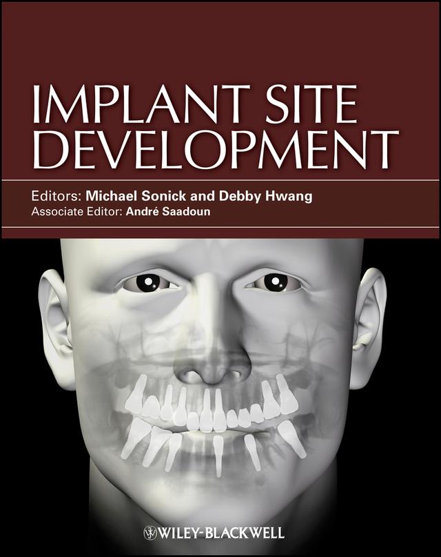 Implant Site Development by Debby Hwang, Michael Sonick