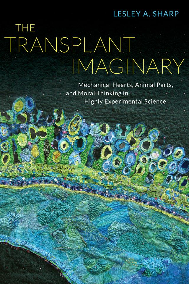 The Transplant Imaginary by Lesley A. Sharp