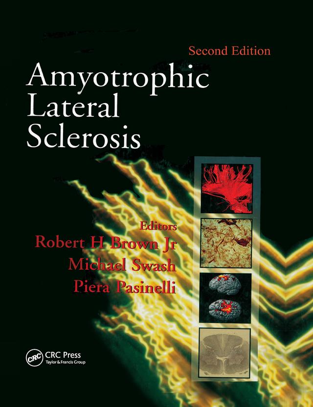 Amyotrophic Lateral Sclerosis, Second Edition by Michael Swash, Piera Pasinelli, Robert H. Brown
