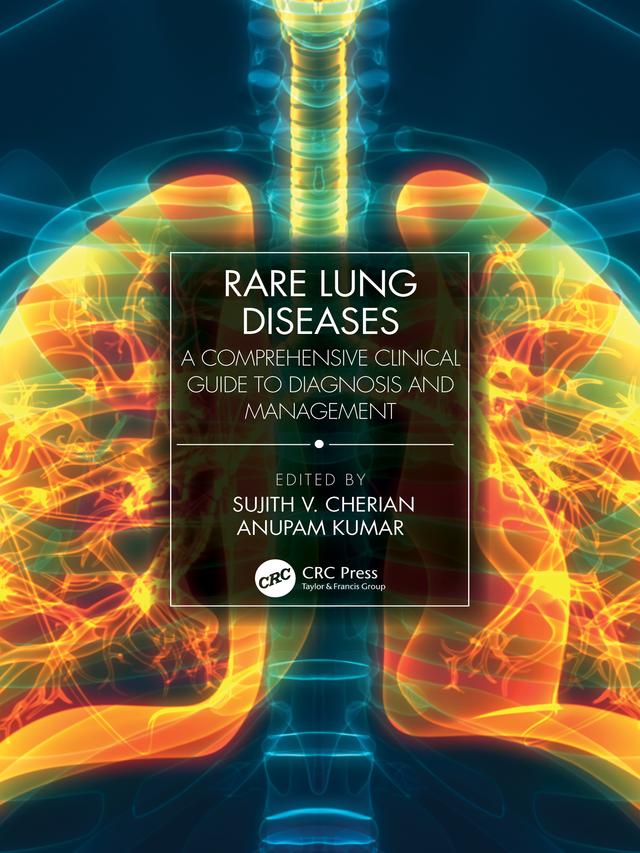 Rare Lung Diseases by Anupam Kumar, Sujith V. Cherian