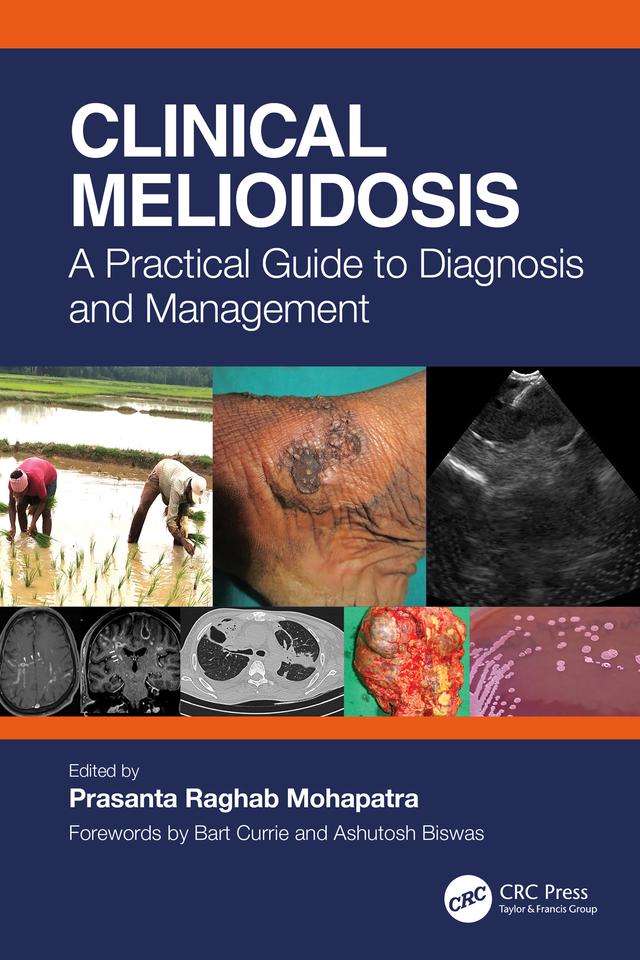 Clinical Melioidosis by Prasanta Raghab Mohapatra