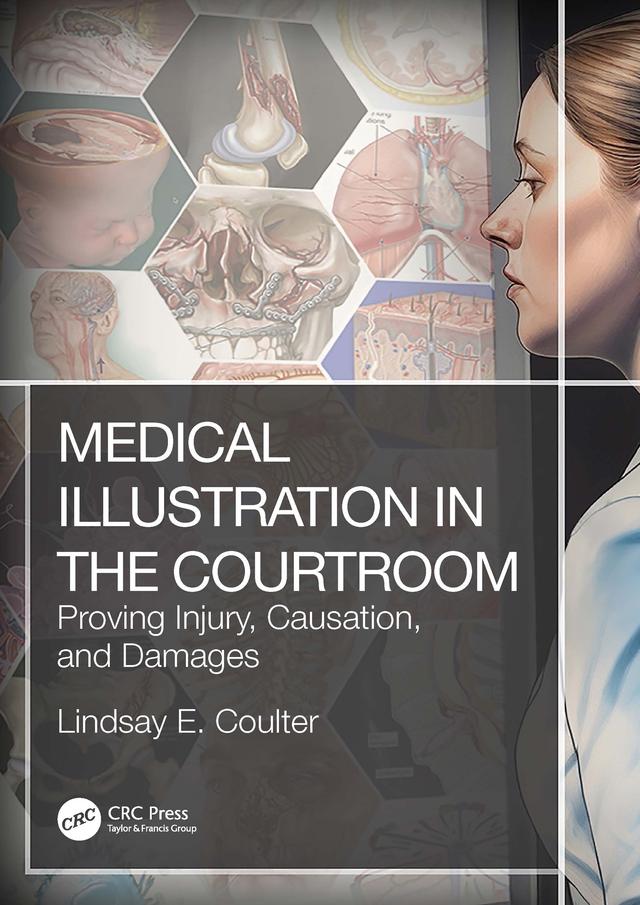 Medical Illustration in the Courtroom by Lindsay E. Coulter