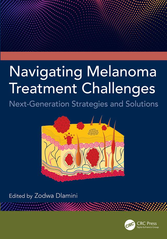 Navigating Melanoma Treatment Challenges by Zodwa Dlamini