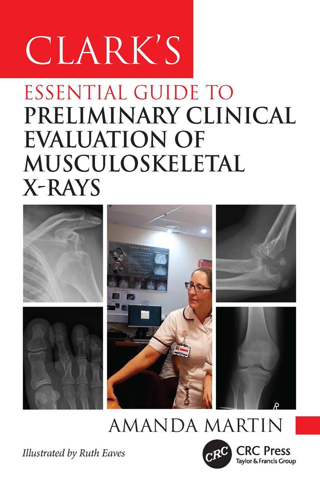 Clark’s Essential Guide to Preliminary Clinical Evaluation of Musculoskeletal X-rays by Amanda Martin, Ruth Eaves