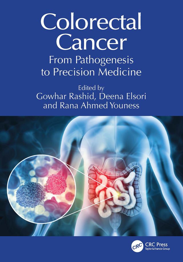 Colorectal Cancer by Deena Elsori, Gowhar Rashid, Rana Ahmed Youness