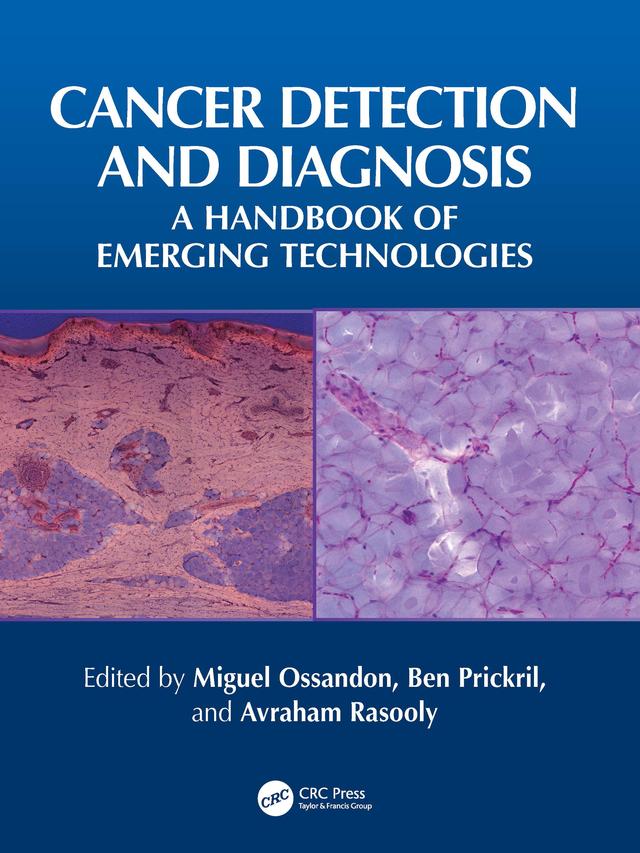 Cancer Detection and Diagnosis by Avraham Rasooly, Ben Prickril, Miguel Ossandon
