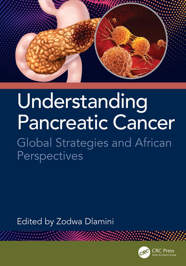 Understanding Pancreatic Cancer by Zodwa Dlamini