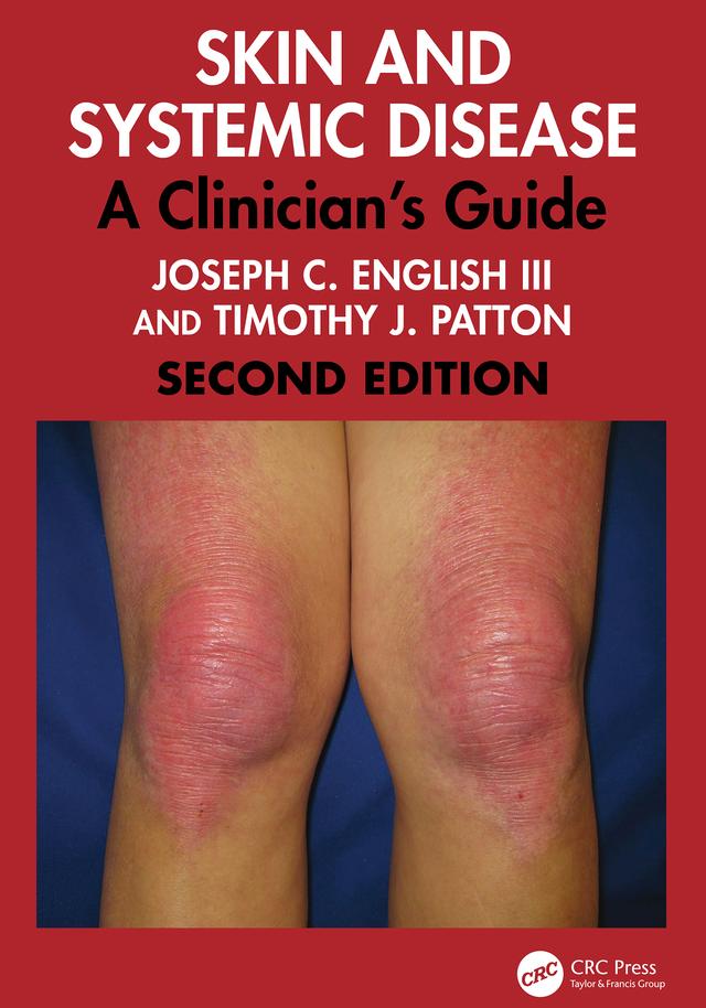 Skin and Systemic Disease by Joseph C. English III, Timothy J. Patton