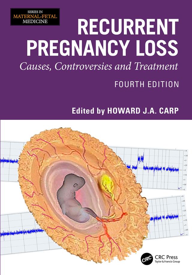 Recurrent Pregnancy Loss by Howard J A Carp
