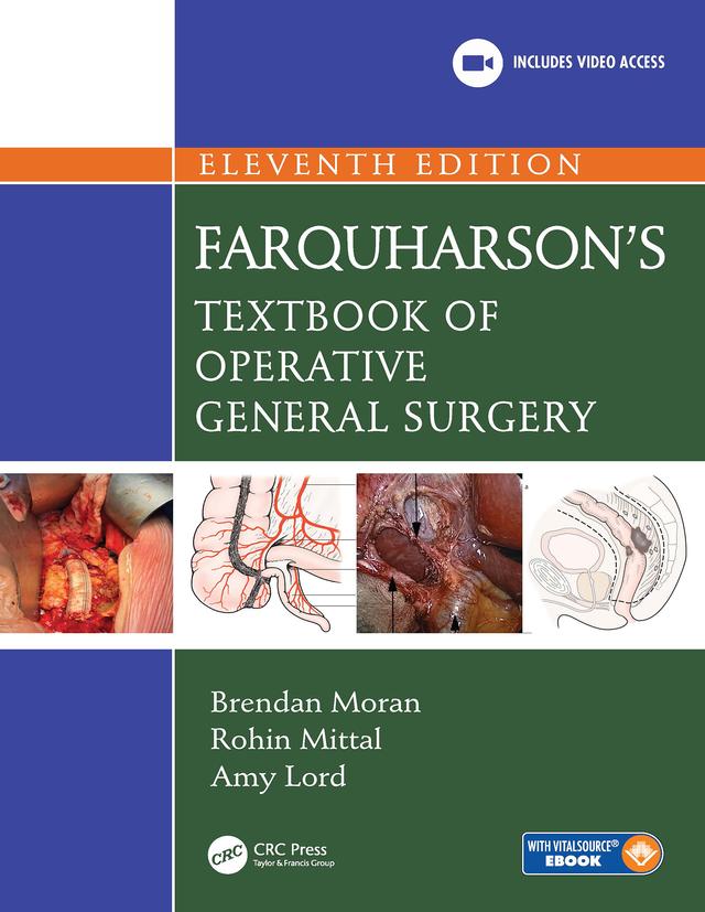 Farquharson's Textbook of Operative General Surgery by Amy Lord, Brendan Moran, Rohin Mittal