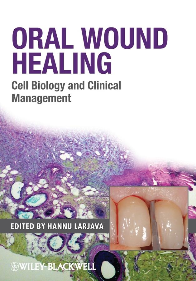 Oral Wound Healing by Hannu Larjava