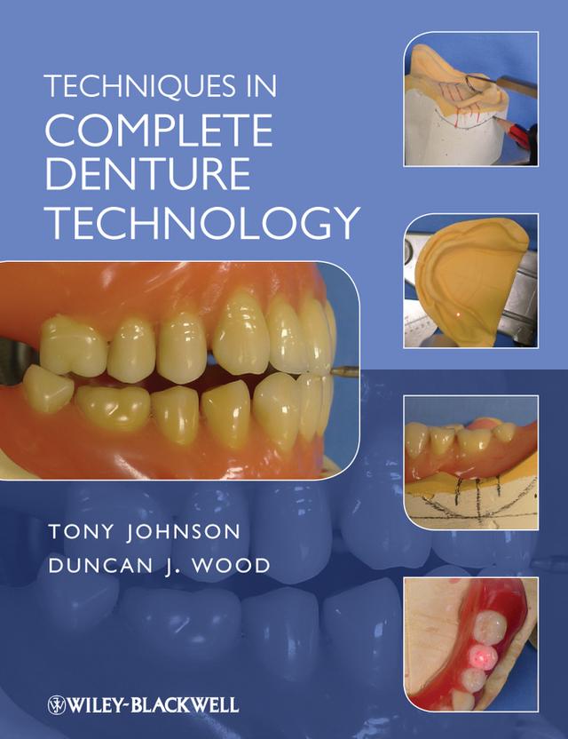 Techniques in Complete Denture Technology by Duncan J. Wood, Tony Johnson