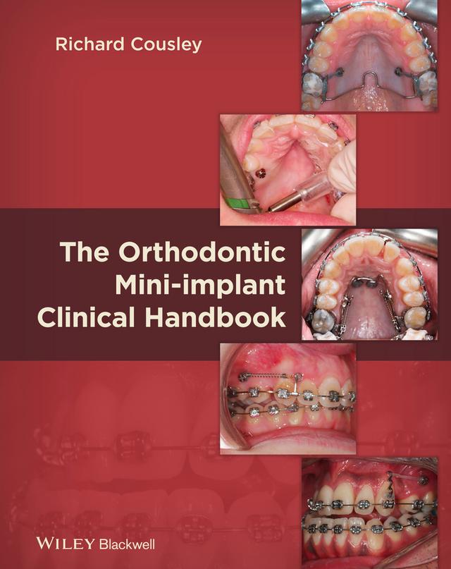 The Orthodontic Mini-implant Clinical Handbook by Richard Cousley
