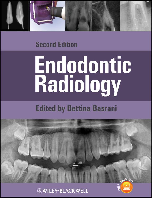 Endodontic Radiology by Bettina Basrani