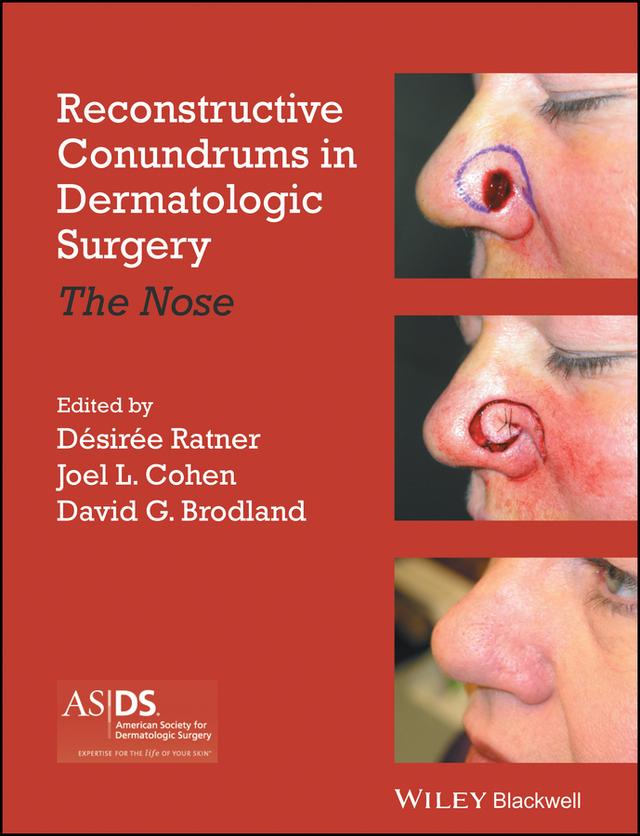 Reconstructive Conundrums in Dermatologic Surgery by David Brodland, Desiree S. Ratner, Joel L. Cohen
