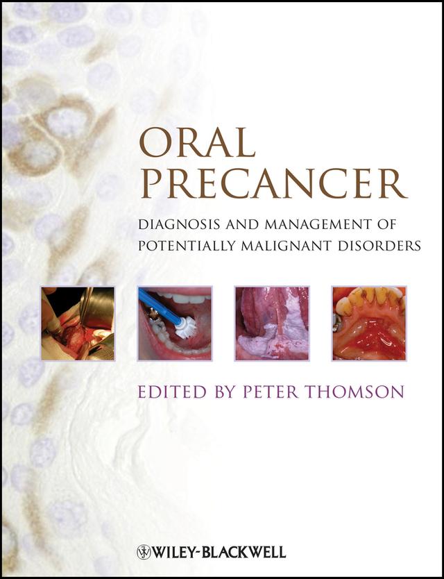 Oral Precancer by Peter Thomson