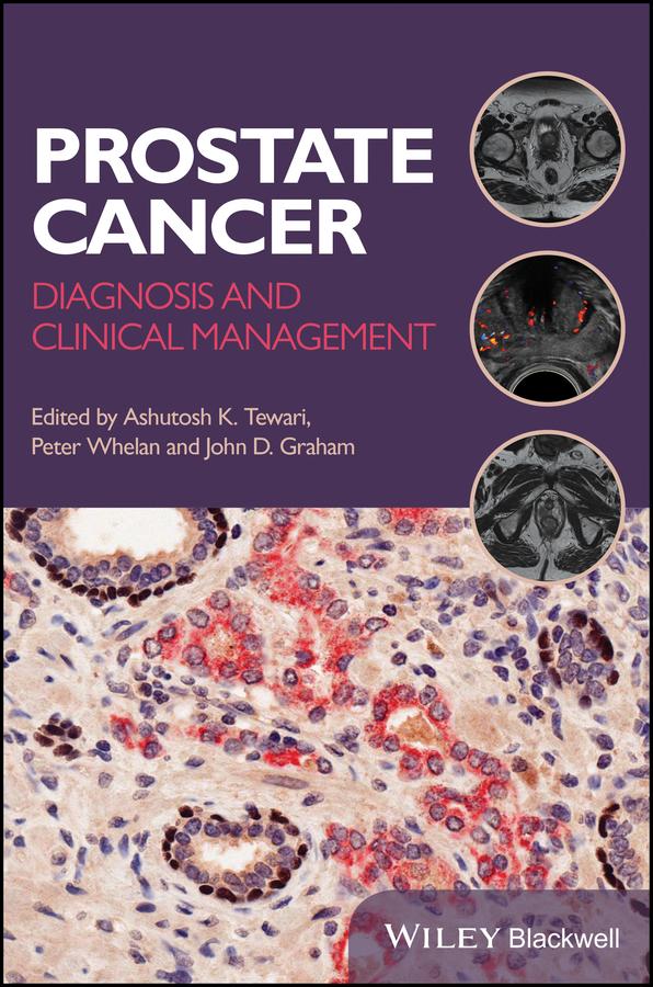 Prostate Cancer by Ashutosh K. Tewari, John D. Graham, Peter Whelan