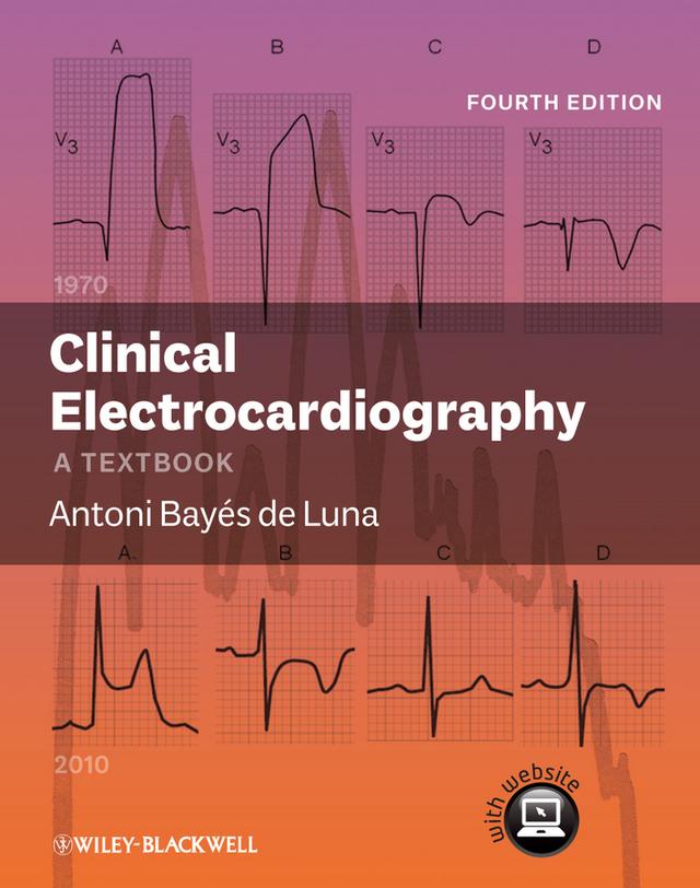 Clinical Electrocardiography by Antoni Bayés de Luna