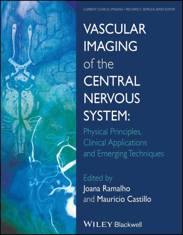 Vascular Imaging of the Central Nervous System by Joana Ramalho, Mauricio Castillo