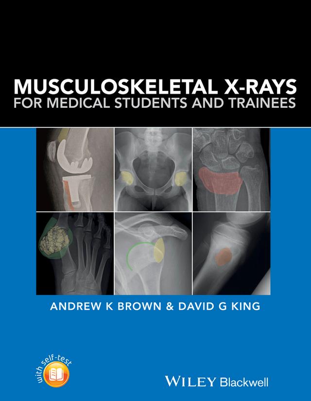 Musculoskeletal X-Rays for Medical Students and Trainees by Andrew Brown, David G. King