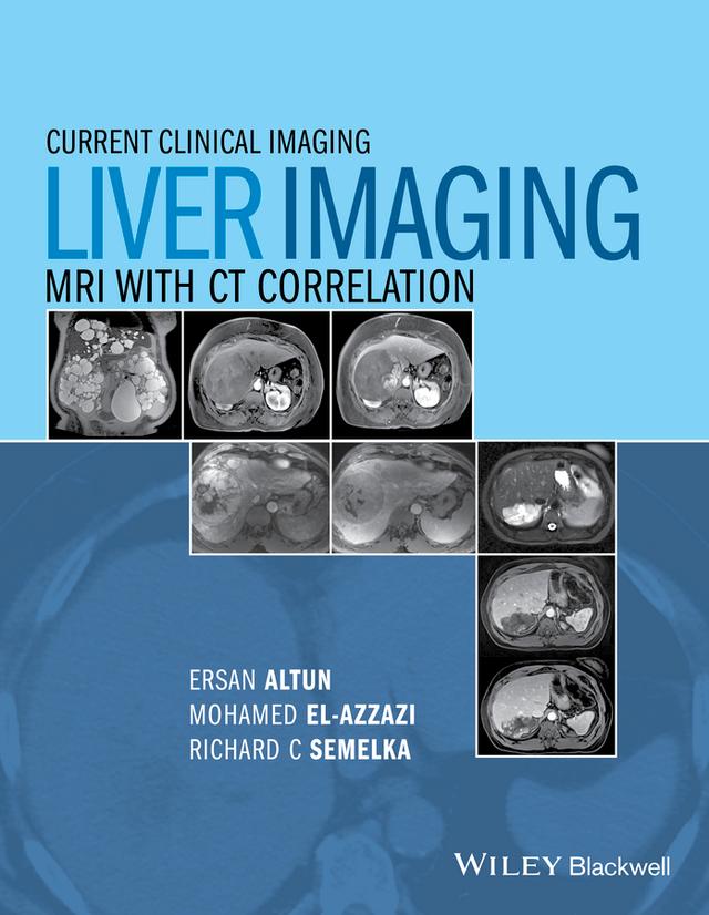 Liver Imaging by Ersan Altun, Mohamed El-Azzazi, Richard C. Semelka