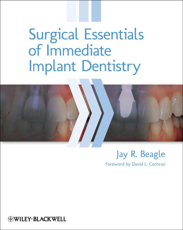 Surgical Essentials of Immediate Implant Dentistry by Jay R. Beagle
