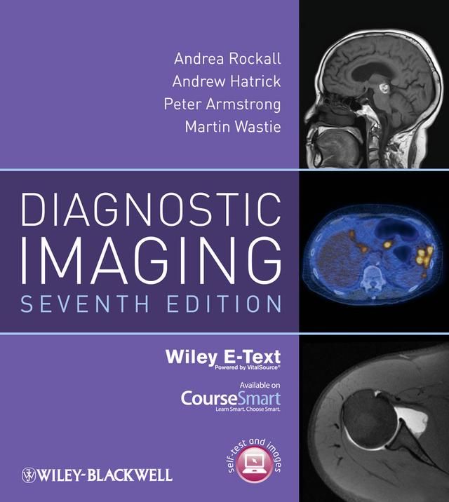 Diagnostic Imaging by Andrea G. Rockall, Andrew Hatrick, Martin Wastie, Peter Armstrong