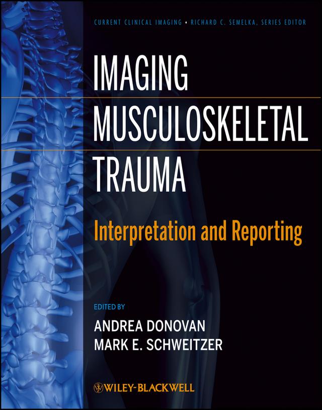 Imaging Musculoskeletal Trauma by Andrea Donovan, Mark E. Schweitzer