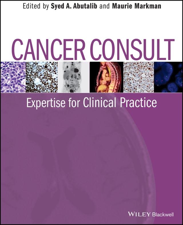 Cancer Consult by Maurie Markman, Syed A. Abutalib