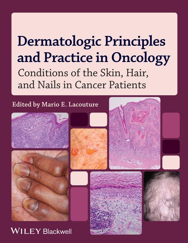 Dermatologic Principles and Practice in Oncology by Mario E. Lacouture