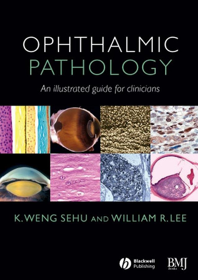 Ophthalmic Pathology by K. Weng Sehu, William R. Lee