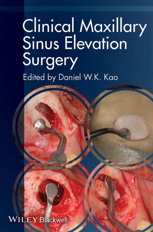 Clinical Maxillary Sinus Elevation Surgery by Daniel W. K. Kao