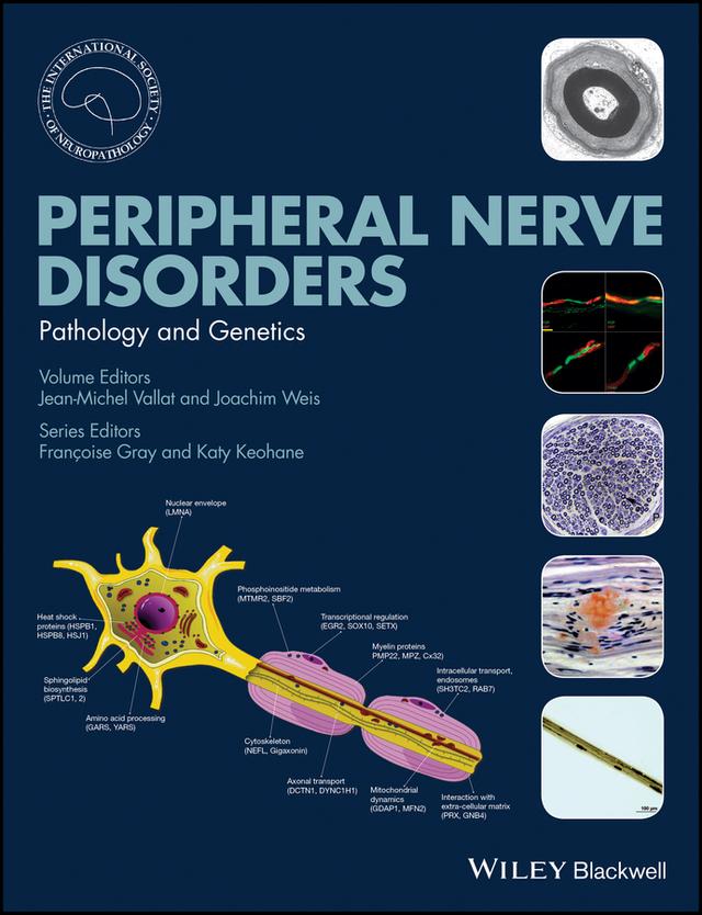 Peripheral Nerve Disorders by Jean-Michel Vallat, Joachim Weiss