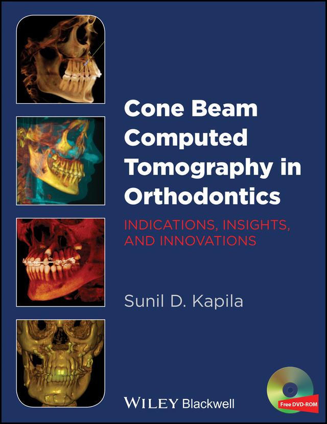Cone Beam Computed Tomography in Orthodontics by Sunil D. Kapila