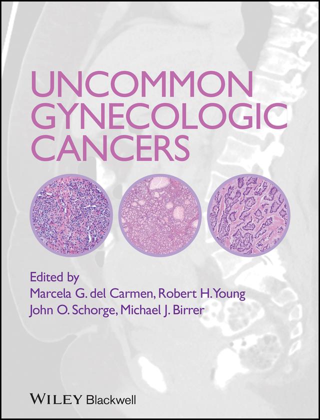 Uncommon Gynecologic Cancers by John O. Schorge, Marcela del Carmen, Robert H. Young