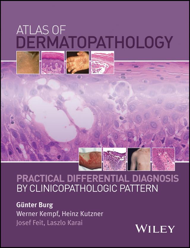 Atlas of Dermatopathology by Günter Burg, Heinz Kutzner, Josef Feit, Laszlo Karai, Werner Kempf