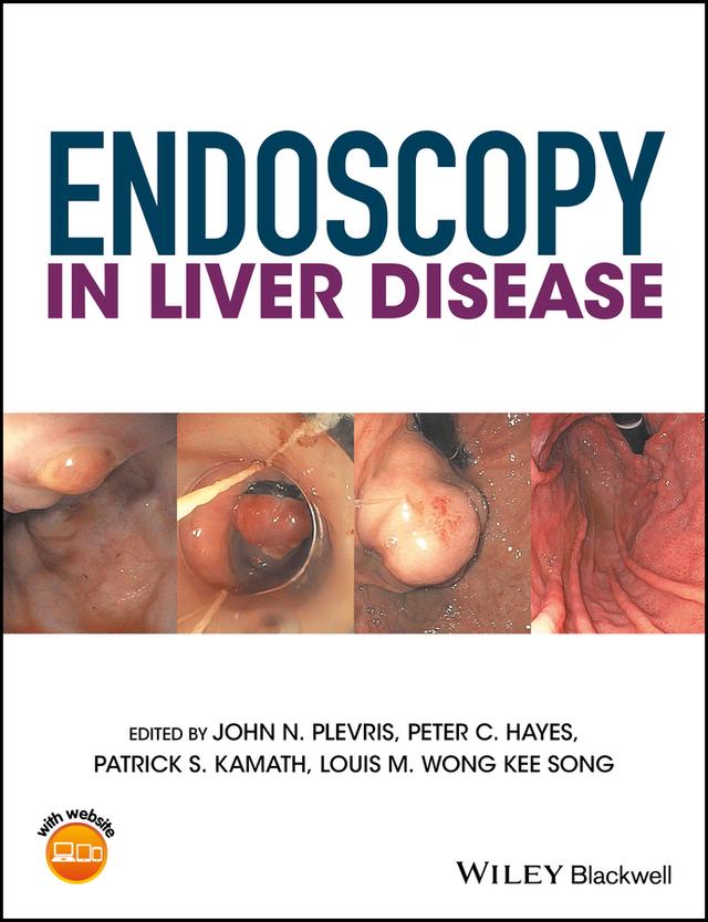 Endoscopy in Liver Disease by John N. Plevris, Louis-Michel Wong Kee Song, Patrick S. Kamath, Peter C. Hayes
