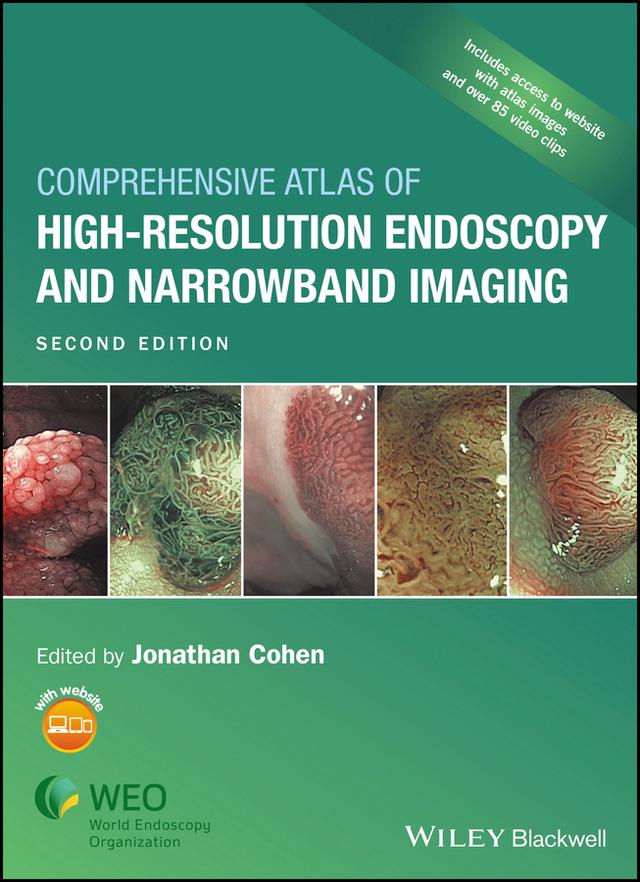Comprehensive Atlas of High-Resolution Endoscopy and Narrowband Imaging by Jonathan Cohen