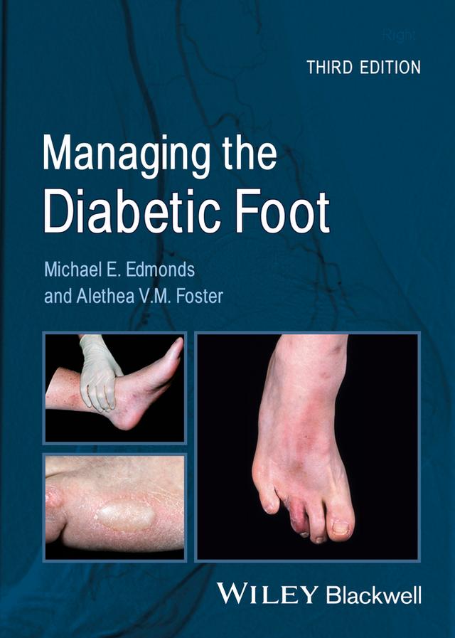 Managing the Diabetic Foot by Alethea V. M. Foster, Michael E. Edmonds