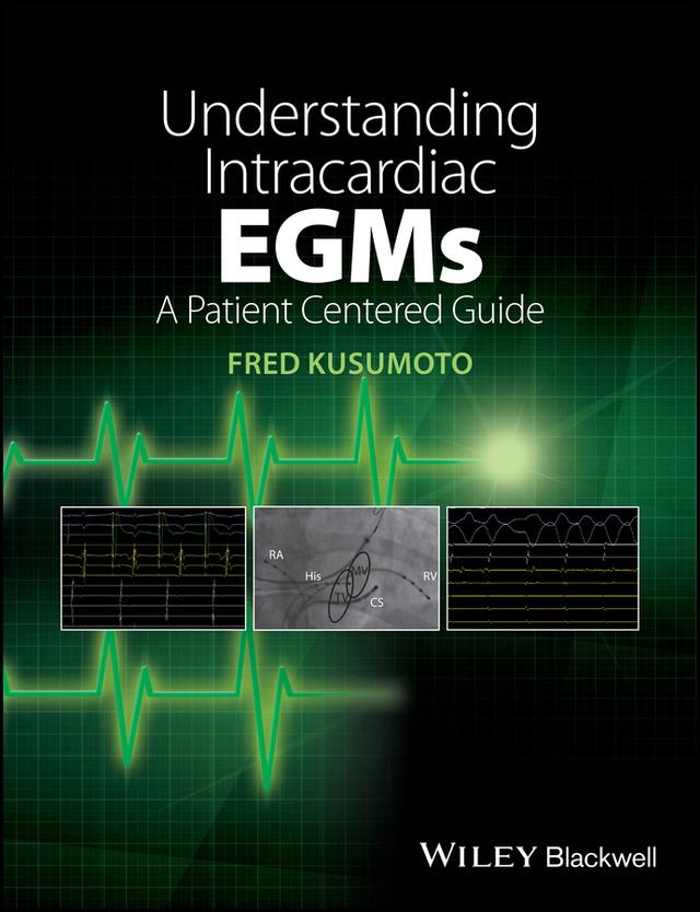Understanding Intracardiac EGMs by Fred M. Kusumoto