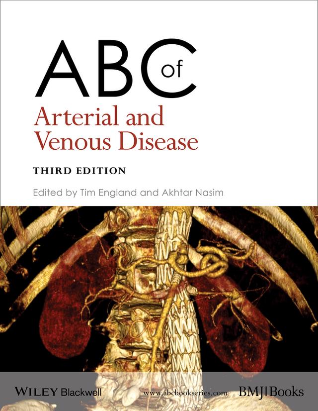 ABC of Arterial and Venous Disease by Akhtar Nasim, Tim England