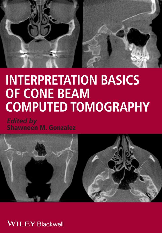 Interpretation Basics of Cone Beam Computed Tomography by Shawneen M. Gonzalez