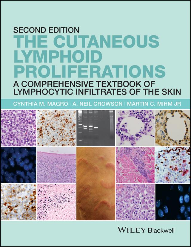 The Cutaneous Lymphoid Proliferations by A. Neil Crowson, Cynthia M. Magro, Martin C. Mihm, Jr
