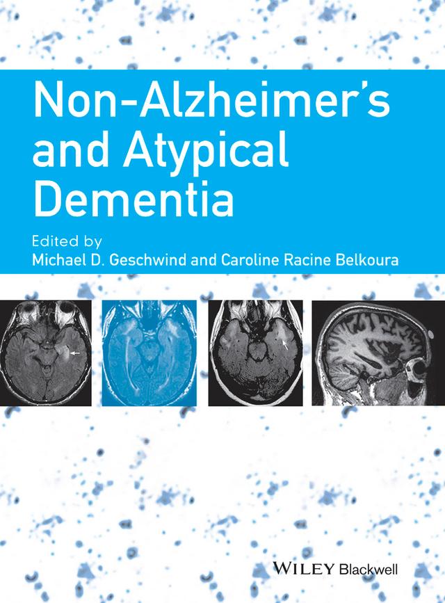 Non-Alzheimer's and Atypical Dementia by Caroline Racine Belkoura, Michael D. Geschwind