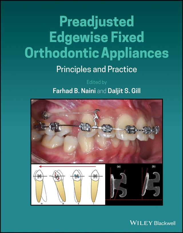 Preadjusted Edgewise Fixed Orthodontic Appliances by Daljit S. Gill, Farhad B. Naini