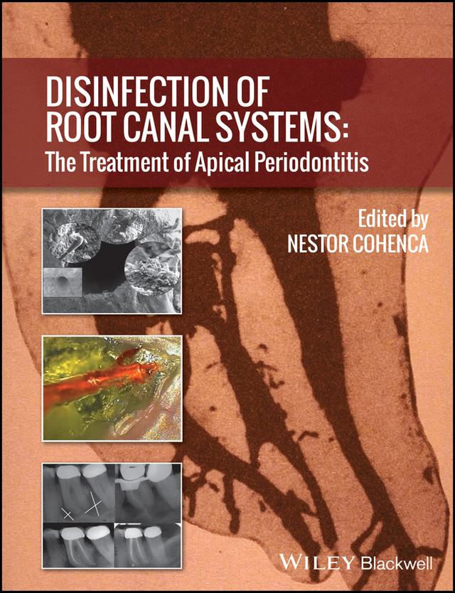 Disinfection of Root Canal Systems by Nestor Cohenca