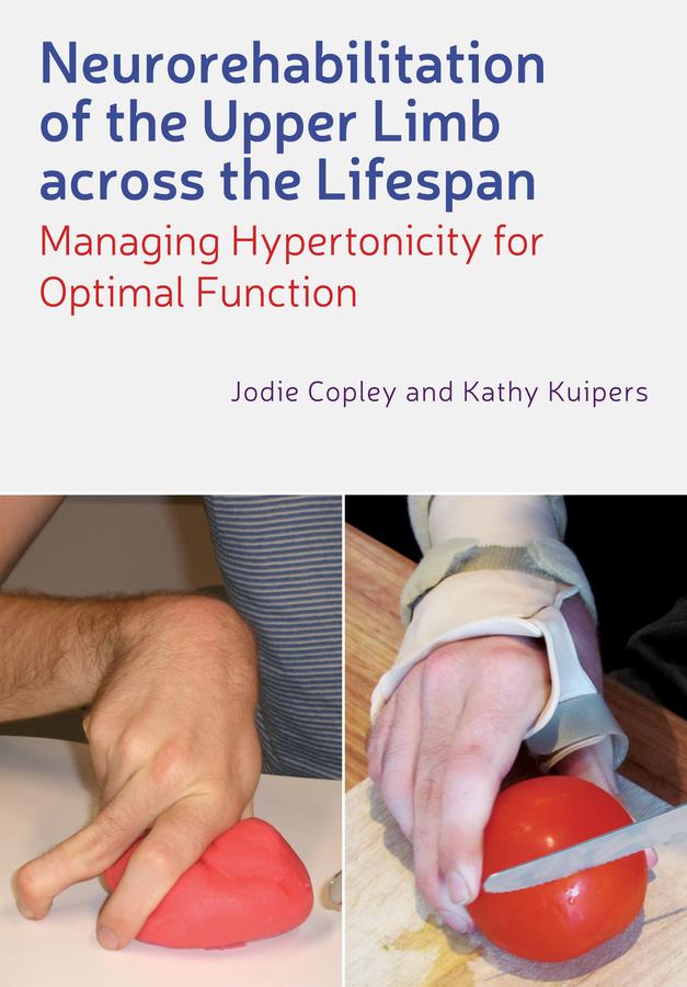 Neurorehabilitation of the Upper Limb Across the Lifespan by Jodie Copley, Kathy Kuipers